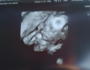 26840704_1816228908399047_1856347653179181182_o